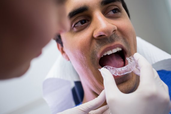 İnvisalign Fiyatı Ne Kadar?