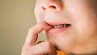 Kötü Alışkanlıklar Ortodontik Probleme Sebep Olur mu?